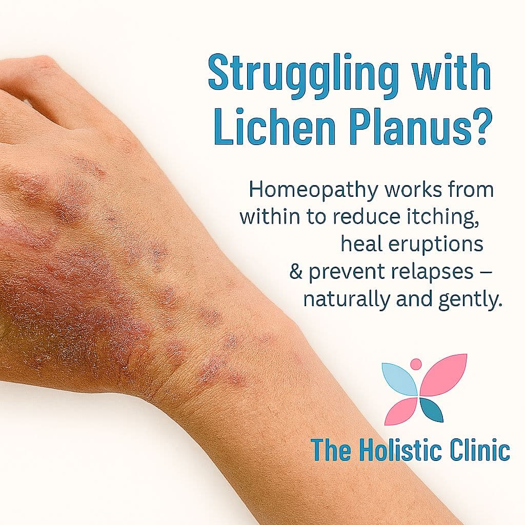 Struggling with Lichen Planus