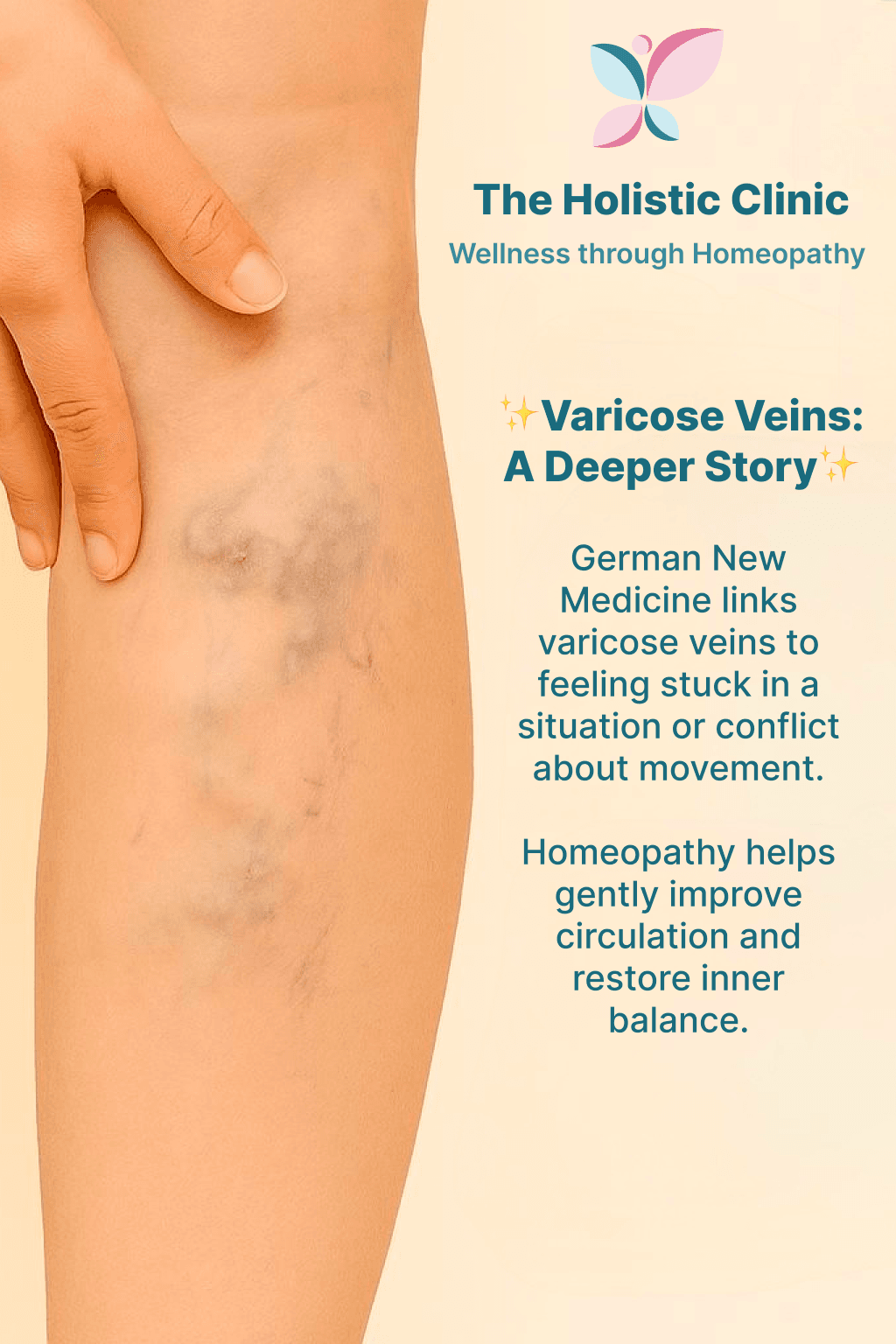Vericose Vein Treatment