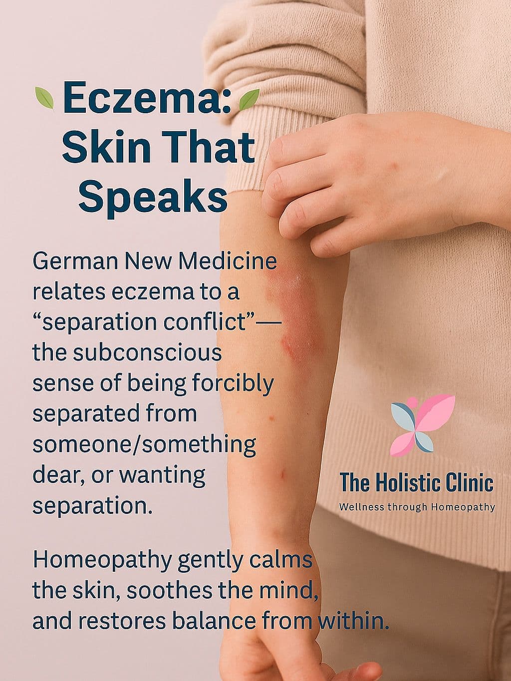 Eczema