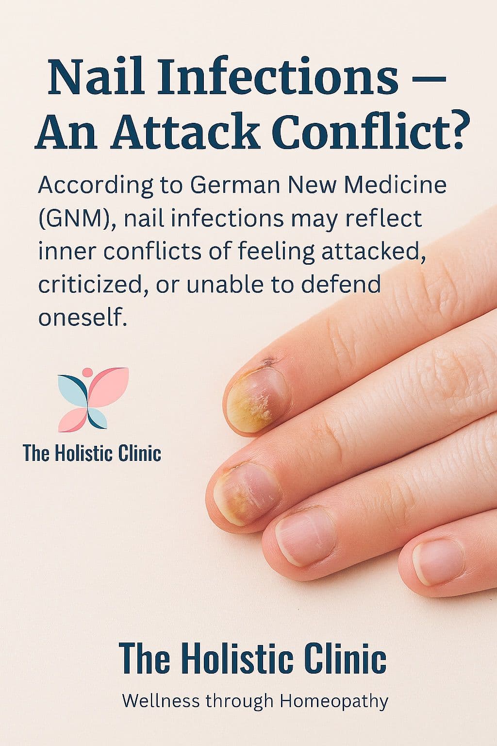 Nail Infections
