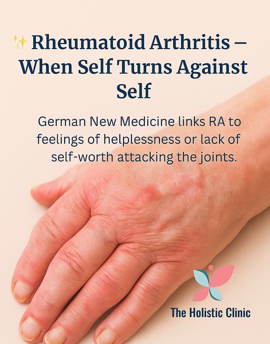 Rheumatoid Arthritis