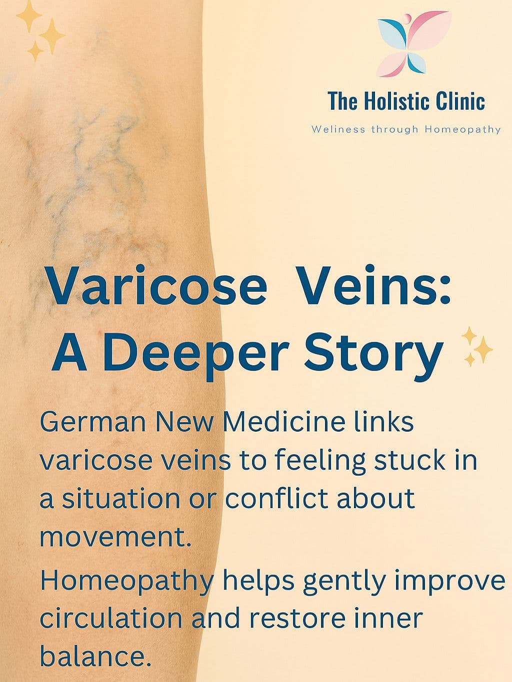Varicose Veins